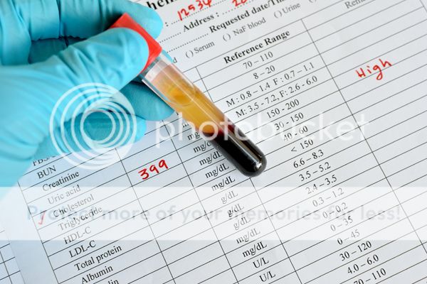 Cholesterol