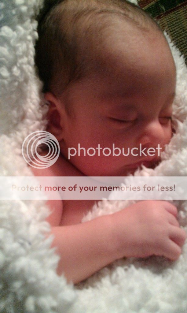 High Baby Hairline | BabyCenter